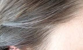 Photo of سفیدی مو علت و درمان